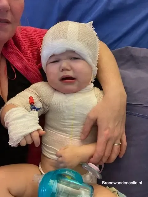 Anna wordt vastgehouden door haar moeder, met verband om haar hoofd en arm.
