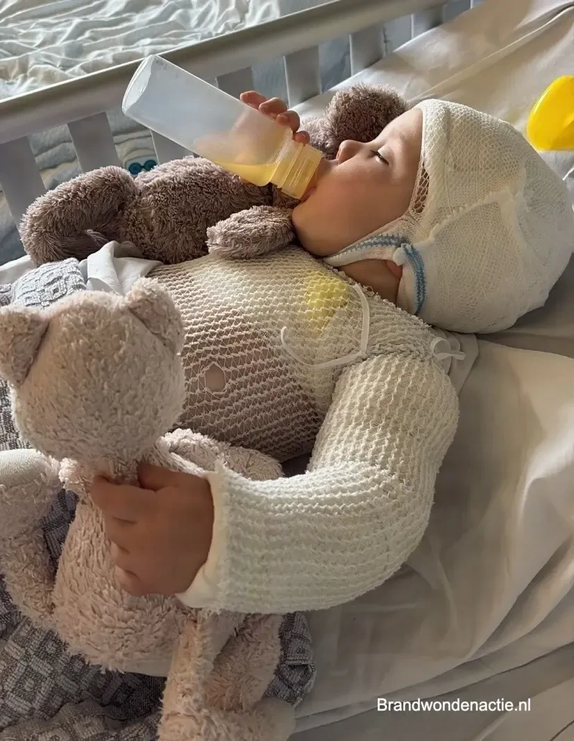 Anne drinkt een flesje in bed, met een verbandmuts op en een netverband om haar bovenlichaam.
