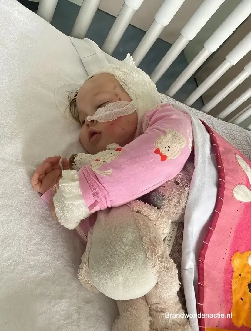 Anne slaapt met een verband om haar hoofd, kort na het ongeval.