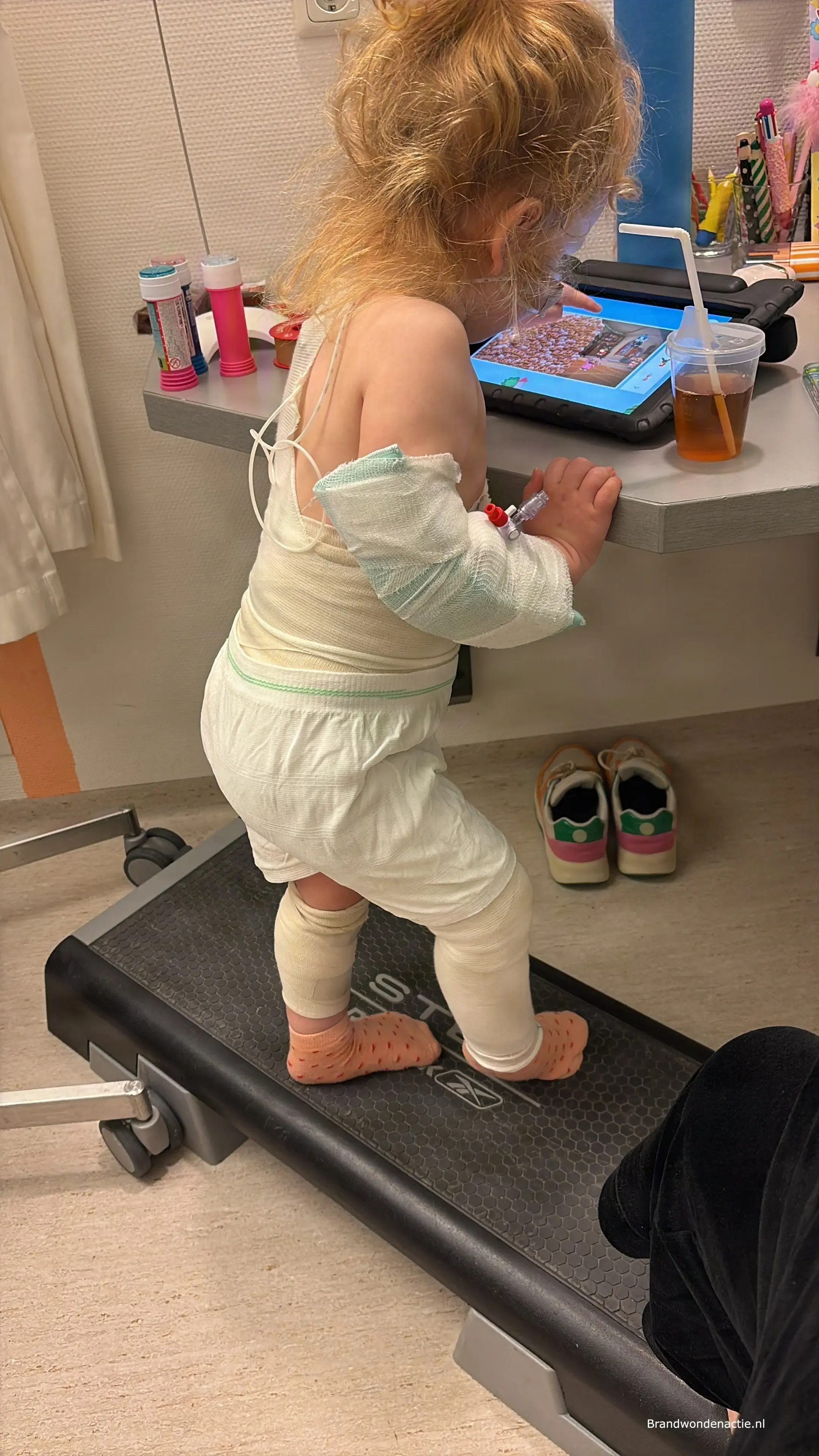Guusje oefent op een loopband tijdens haar revalidatie, met verband om haar arm en benen.
